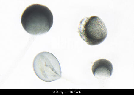 Fotografia al microscopio di Rhizopus Foto Stock