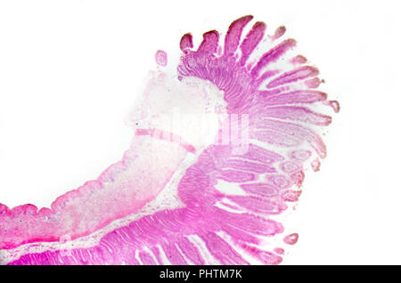 Fotografia di microscopia. Il piccolo intestino sezione trasversale. Foto Stock