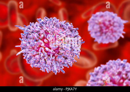 La leucemia a cellule capellute. Computer illustrazione di una anormale delle cellule bianche del sangue (B-) di linfociti da un paziente con leucemia a cellule capellute. Queste cellule mostrano i caratteristici capelli-come proiezioni citoplasmatica e ruffles sulle loro superfici. La leucemia è un tumore del sangue in cui il sangue-tessuto di produzione nel midollo osseo produce un numero eccessivo di immaturi di cellule bianche del sangue, come si vede qui che compromettono la funzione delle cellule ematiche normali. Il sistema immunitario è pertanto indebolita. La leucemia a cellule capellute è una rara forma di leucemia che interessa soprattutto gli uomini. La maggior parte dei pazienti sopravvive per più di cinque anni dopo la diagnosi. Foto Stock