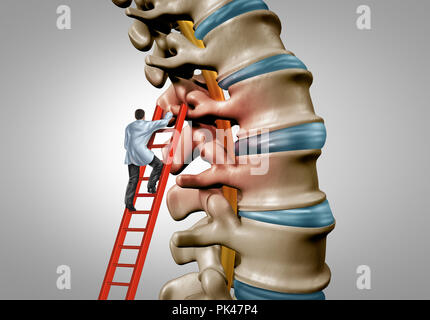 La terapia della colonna vertebrale e la stenosi spinale medicina e chirurgia concetto come una malattia degenerativa chirurgia nel vertebre umane come un medico curante . Foto Stock