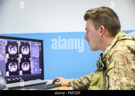 Provincia di Kandahar, Afghanistan (5 agosto 2018) -- STATI UNITI Navy Corpsman ospedale di terza classe Thomas Fite, un tecnico di radiologia per Kandahar Airfield il ruolo della NATO III multinazionale unità mediche, guarda i risultati di un esame a raggi x, 5 agosto 2018, per aiutare i suoi omologhi afgano durante una consulenza medica visita a Kandahar regionale Ospedale Militare, Camp Hero a Kandahar, Afghanistan. I membri del personale del ruolo III SVOLGIMENTO visite di routine per KRMH per formare e consigliare afgano del personale medico. Foto Stock