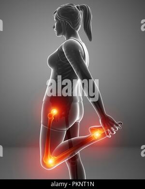 Donna con dolore alle gambe, illustrazione del computer. Foto Stock