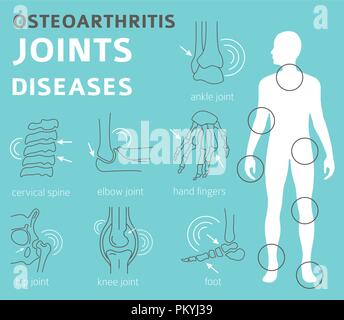 Giunti a malattie. Artrite, osteoartrite sintomi, trattamento icon set. Infografico medica design. Illustrazione Vettoriale Illustrazione Vettoriale