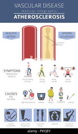 Malattie vascolari. I sintomi di aterosclerosi, trattamento icon set. Infografico medica design. Illustrazione Vettoriale Illustrazione Vettoriale