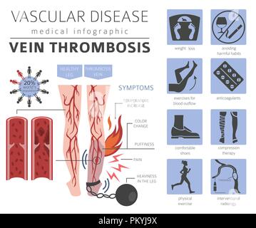 Malattie vascolari. Trombosi della vena sintomi, trattamento icon set. Infografico medica design. Illustrazione Vettoriale Illustrazione Vettoriale