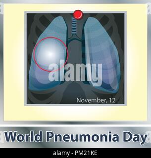 Simbolo di patologia polmonare. La respirazione. Il sistema respiratorio. Malattie respiratorie - cancro asma, tubercolosi, polmonite . Mondo polmonite giorno. Assistenza sanitaria. X-ray dei polmoni Illustrazione Vettoriale