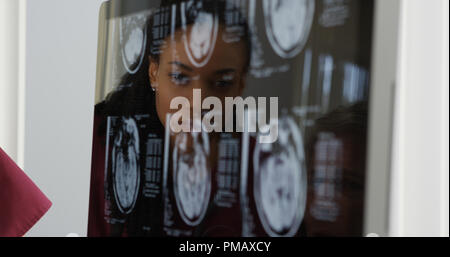 I medici rivedendo il cervello a raggi x Foto Stock