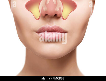 Volto femminile mostra seni nasali con freddo su sfondo bianco. Foto Stock