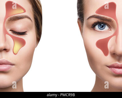 Volto femminile mostra seni nasali con freddo su sfondo bianco. Foto Stock