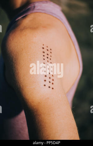 Close-up di un uomo di braccio con Kambo cerimonia segna la masterizzazione Foto Stock
