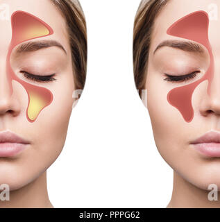Volto femminile mostra seni nasali con freddo su sfondo bianco. Foto Stock