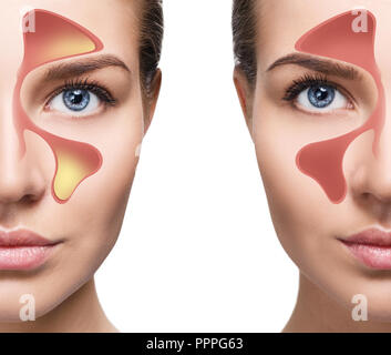 Volto femminile mostra seni nasali con freddo su sfondo bianco. Foto Stock