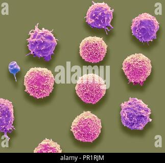 Le cellule bianche del sangue e delle piastrine. Color scanning electron microfotografia (SEM) delle cellule bianche del sangue e una singola piastrina (blu). Le piastrine sono frammenti di cellule bianche del sangue che in circostanze normali sono piccole e biconcava in forma. Tuttavia, se vi è una pausa nella superficie di un vaso sanguigno le piastrine vengono in contatto con molecole non sono usati per e diventano attive. Ingrandimento: x3000 quando stampata a 10 cm di larghezza. Foto Stock