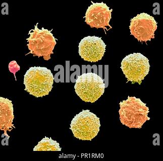 Le cellule bianche del sangue e delle piastrine. Color scanning electron microfotografia (SEM) delle cellule bianche del sangue e una singola piastrina (blu). Le piastrine sono frammenti di cellule bianche del sangue che in circostanze normali sono piccole e biconcava in forma. Tuttavia, se vi è una pausa nella superficie di un vaso sanguigno le piastrine vengono in contatto con molecole non sono usati per e diventano attive. Ingrandimento: x3000 quando stampata a 10 cm di larghezza. Foto Stock