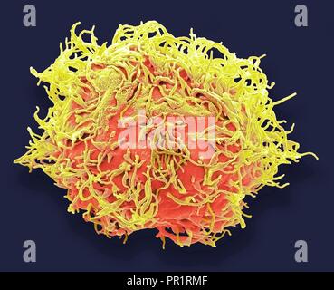 Cellule staminali mesenchimali. Color scanning electron microfotografia (SEM) di un essere umano di cellule staminali mesenchimali (MSC). I MSC sono multipotent stromali (tessuto connettivo) cellule che possono differenziarsi in una varietà di tipi cellulari, includenti osteoblasti (cellule ossee), condrociti (cellule cartilaginee), adipociti (cellule di grasso). Il più giovane, più primitivo CSM possono essere ottenute dal tessuto del cordone ombelicale. Ingrandimento: x3000 quando stampate 10 centimetri di larghezza. Foto Stock