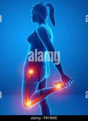 Donna con dolore alle gambe, illustrazione del computer. Foto Stock