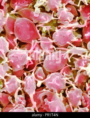 Piastrine attivate, colorata di microfotografia electron scansione (SEM). Le piastrine del sangue sono frammenti di cellule che svolgono un ruolo essenziale nella coagulazione del sangue e la riparazione della lesione, e può anche attivare alcune risposte immunitarie. Essi sono formati nel midollo rosso, polmoni, milza e dalla frammentazione di grandi cellule note come dei megacariociti. Le piastrine nel sangue sono piccoli dischi di forma ovale e sono denominate piastrine non attivate o trombociti. Essi sono il corpo della prima linea di difesa contro l'eccessiva perdita di sangue. Ingrandimento: x2.000 a largo 10 cm. Foto Stock