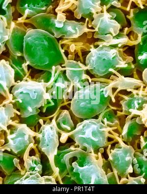 Piastrine attivate, colorata di microfotografia electron scansione (SEM). Le piastrine del sangue sono frammenti di cellule che svolgono un ruolo essenziale nella coagulazione del sangue e la riparazione della lesione, e può anche attivare alcune risposte immunitarie. Essi sono formati nel midollo rosso, polmoni, milza e dalla frammentazione di grandi cellule note come dei megacariociti. Le piastrine nel sangue sono piccoli dischi di forma ovale e sono denominate piastrine non attivate o trombociti. Essi sono il corpo della prima linea di difesa contro l'eccessiva perdita di sangue. Ingrandimento: x2.000 a largo 10 cm. Foto Stock