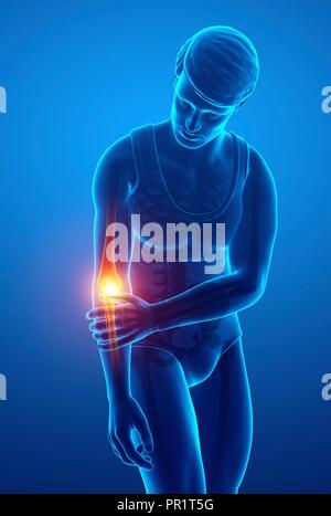 L'uomo con il gomito dolore, illustrazione del computer. Foto Stock