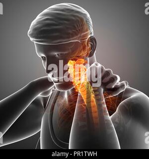 Uomo con dolore al collo, illustrazione del computer. Foto Stock