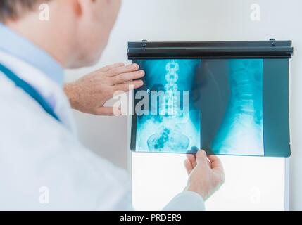 Caucasian medico nel suo 50s Controllo di immagini a raggi x. Radiografia digitale. Tema del settore sanitario. Foto Stock