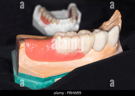 Gomma artificiale con denti di close-up, immagine di sfondo Foto Stock