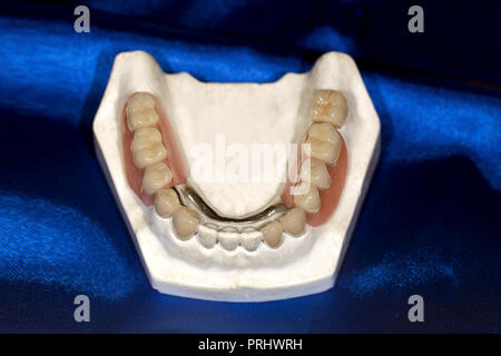 Gomma artificiale con denti di close-up, su uno sfondo blu Foto Stock