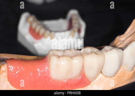 Gomma artificiale con denti di close-up, immagine di sfondo Foto Stock