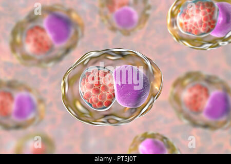 Chlamydia trachomatis batteri. Computer illustrazione che mostra un composto di inclusione di un gruppo di chlamydia reticolano corpi (intracellulare dello stadio di moltiplicazione, piccole sfere rosse) nelle vicinanze del nucleo (viola) di una cellula. Chlamydia trachomatis causa una infezione trasmessa sessualmente che possono passare inosservate provocando infertilità. Esso determina anche la malattia dell'occhio tracoma, che può portare alla cecità. Foto Stock