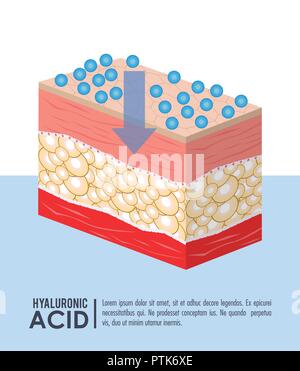 Acido ialuronico Iniezione di riempimento ed infografico Illustrazione Vettoriale