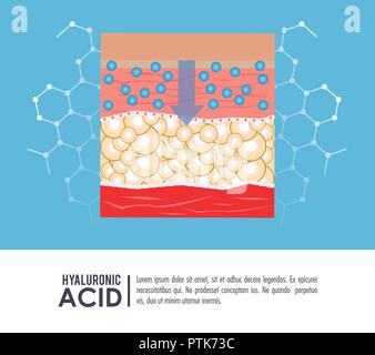 Acido ialuronico Iniezione di riempimento ed infografico Illustrazione Vettoriale
