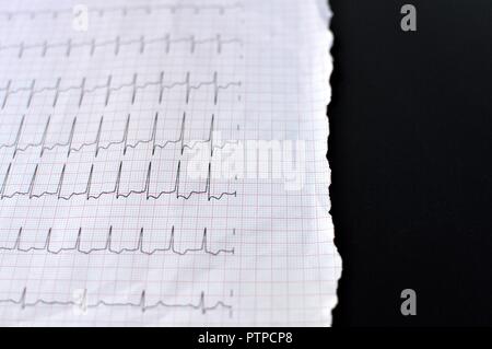 In prossimità di una parte di un elettrocardiogramma in carta stampata sotto forma di cure sanitarie e di concetto medico. Elettrocardiogramma o ECG carta su sfondo nero. Foto Stock