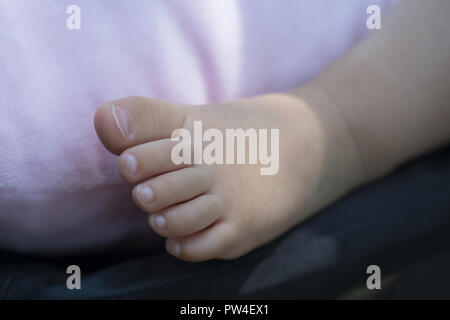 Gara al piede di un sei mesi Baby girl. Foto Stock