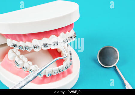 Modello di denti con filo metallico bretelle dentali e specchio di apparecchiature dentali su sfondo blu. Foto Stock