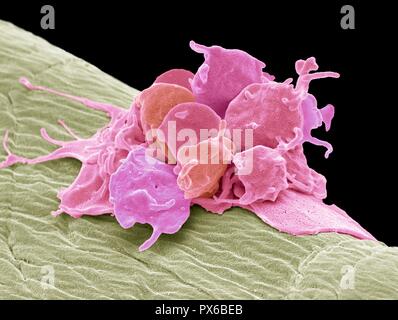 Piastrine attivate. Color scanning electron microfotografia (SEM) di piastrine attivate attaccata alla garza chirurgica. Le piastrine sono piccole cellule del sangue tha Foto Stock