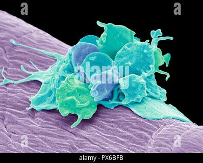 Piastrine attivate. Color scanning electron microfotografia (SEM) di piastrine attivate attaccata alla garza chirurgica. Le piastrine sono piccole cellule del sangue tha Foto Stock