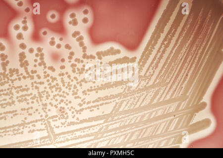 Petrischalen, dettaglio Antibiogramme, Staphylococcus aureus, Pseudomonas aeruginosa, manodopera Versuch, Wissenschaft, Forschung, Bakterien, Anzuchtschalen Foto Stock