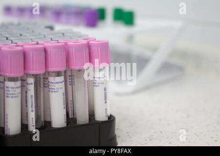 Fryazino, Russia - 06 11 2018: multi-tubi colorati per sangue, articoli medicali, biomateriale raccolta, il concetto di ufficio Foto Stock