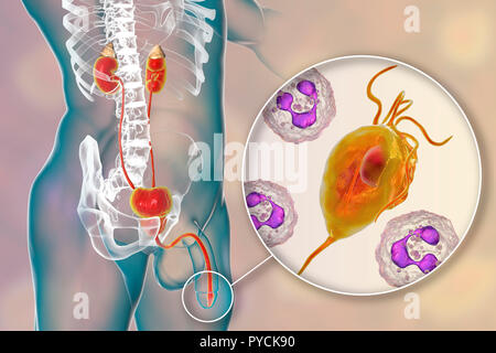 Trichomoniasis, illustrazione. Computer illustrazione del sistema riproduttivo maschile e il microrganismo parassita Trichomonas vaginalis, che è l'agente eziologico di trichomoniasis. Trichomoniasis è una causa comune di uretriti e prostatite e è una malattia sessualmente trasmessa. Foto Stock