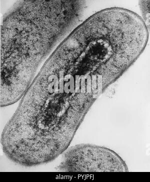 Micrografia elettronica sezione trasversale di batteri Escherichia coli