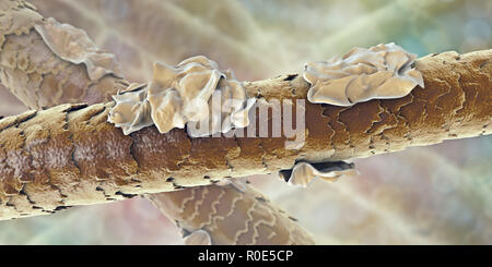 Capelli Umani con forfora, illustrazione del computer. Foto Stock