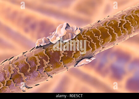 Capelli Umani con forfora, illustrazione del computer. Foto Stock