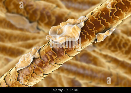 Capelli Umani con forfora, illustrazione del computer. Foto Stock