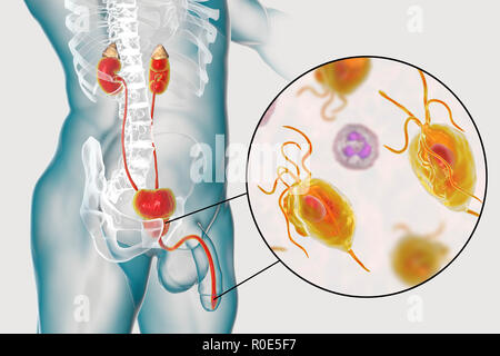 Trichomoniasis. Immagine del calcolatore del maschio sistema urinario e il microrganismo parassita Trichomonas vaginalis, che è l'agente eziologico di trichomoniasis. Trichomoniasis è una causa comune di uretriti e prostatite negli uomini ed è una malattia sessualmente trasmessa. Foto Stock