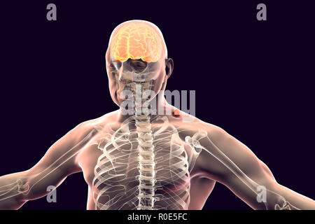 Tick-bourne encefalite, illustrazione del computer. Tick- sostenuti da encefalite (infiammazione del cervello) copre una vasta gamma di malattie che vanno da una grave encefalite paralitica, che si verifica in Siberia e viene trasmesso da Ixodes persulcatus, inferiore rispetto a quella di un paralitico encefalite, che si trova in Europa centrale e trasmesso da Ixodes ricinus. I lavoratori agricoli e forestali sono più frequentemente colpite, come i focolai di infezione sono in ed intorno a zone forestali, i vertebrati di host di manutenzione essendo roditori e la massa di uccelli viventi. Foto Stock