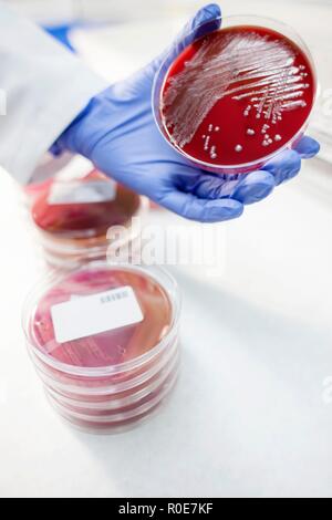 Assistente di laboratorio esaminando la crescita su una capsula di petri, vicino. Foto Stock