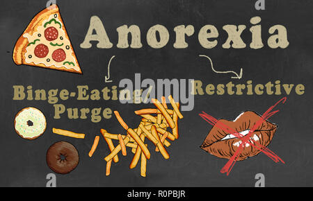 Anoressia illustrato con la classificazione. Due tipi: Binge-Eating/spurgo e restrittivi disturbo alimentare Foto Stock