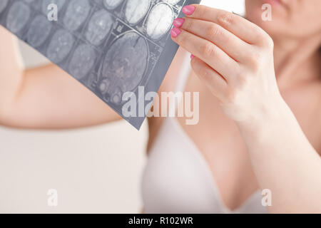 Donna mano azienda MRI brain film per vedere per la diagnostica e la relazione. Concetto medico Foto Stock