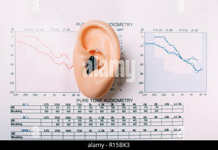 Prova di audizione del concetto. Risultato di audizione esame - audiogramma, apparecchi acustici sul tavolo, vista da sopra. Foto Stock