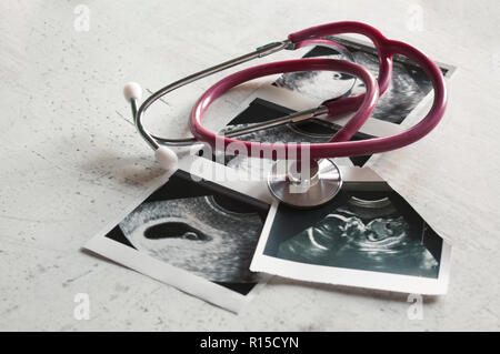 Nelle immagini di ultrasuoni 4 settimane di gravidanza e 20 settimane è un phonendoscope. Il concetto di studio della gravidanza. Osservazione f selettiva Foto Stock